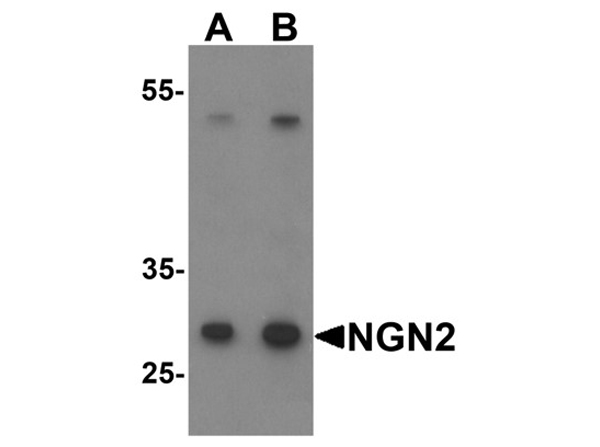 Western blot analysis of NGN2