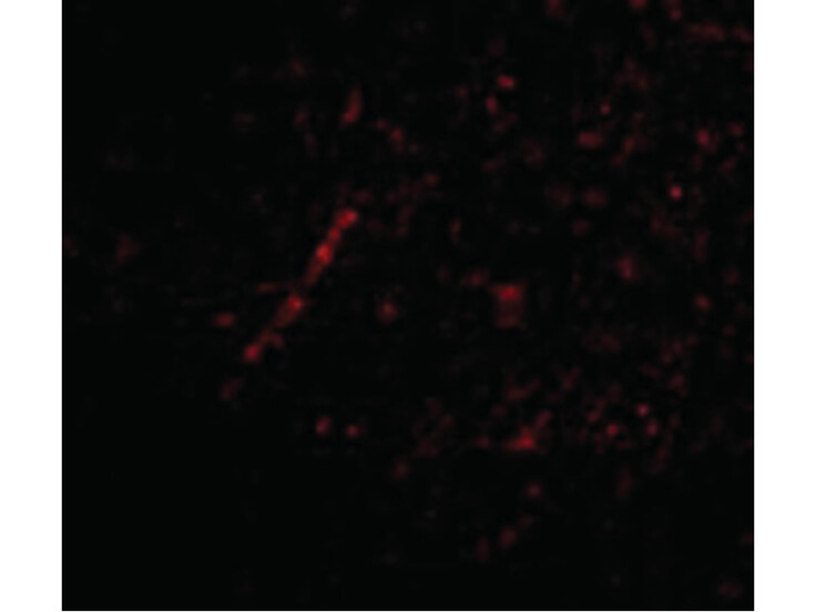 Immunofluorescence of Nhe-1 Antibody
