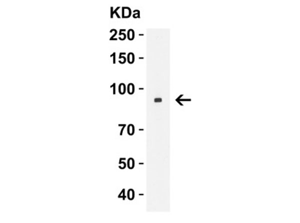 Western Blot of Nhe1