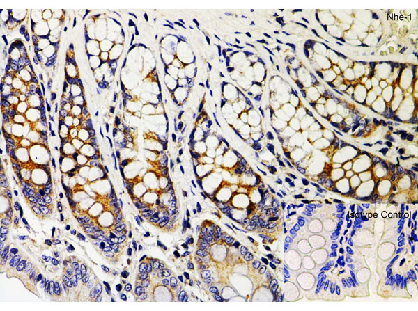 Immunohistochemistry of Nhe-1