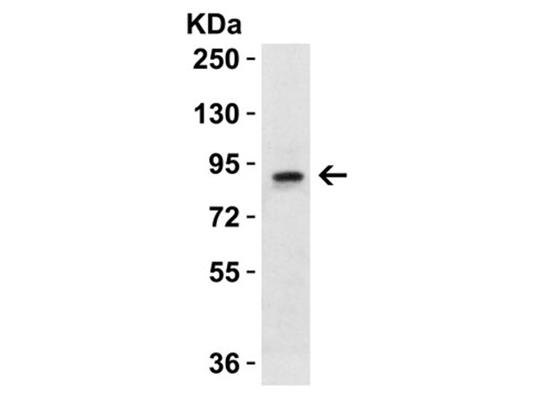 Western Blot of Nhe1
