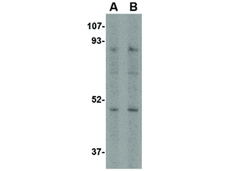 Western Blot of Nhe-1 Antibody