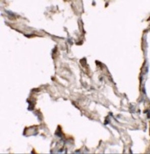 Immunohistochemistry of NIBRIN (CT)