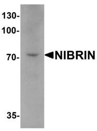 Western blot analysis of NIBRIN (CT)