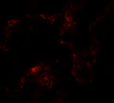 Immunofluorescence of NIBRIN