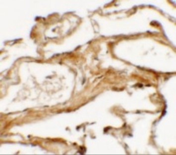 Immunohistochemistry of NIBRIN (NT)