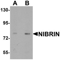 Western blot analysis of NIBRIN