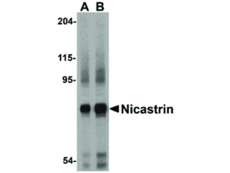Western Blot of Nicastrin Antibody