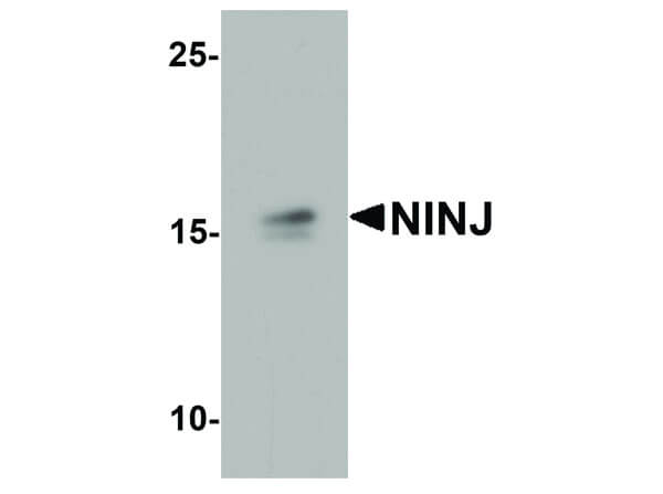 Western Blot of NINJ1 Antibody