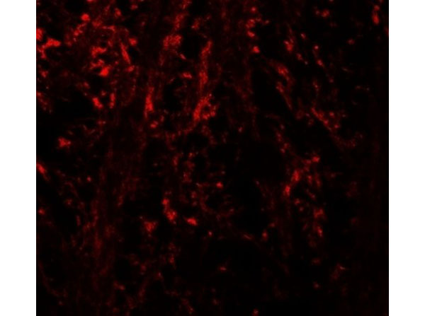Immunofluorescence of NINJ1