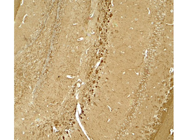 Immunohistochemistry of NINJ1