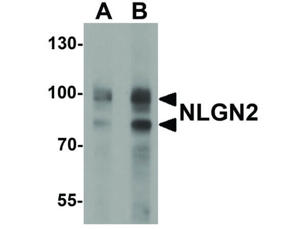 Western Blot of NLGN2 Antibody