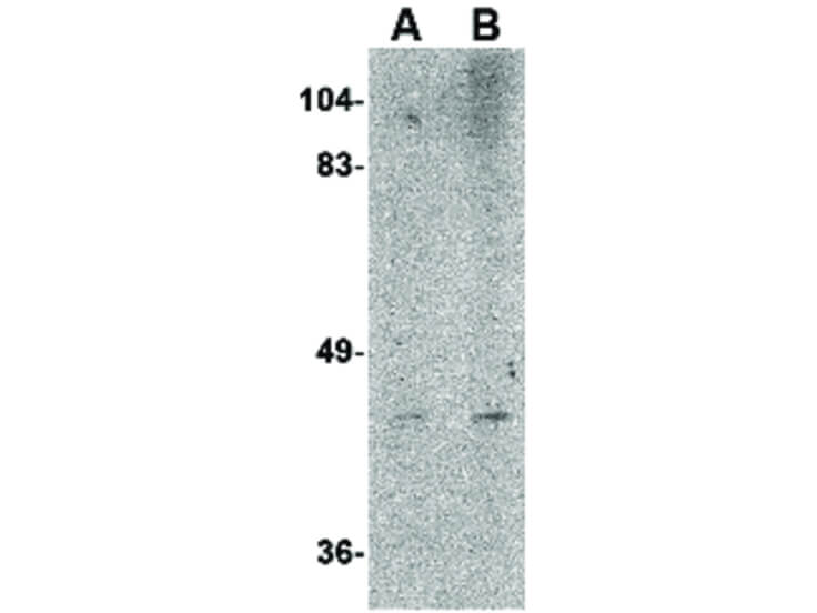 Western Blot of NIPSNAP2 Antibody