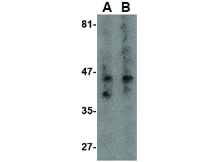 Western Blot of NK3R Antibody
