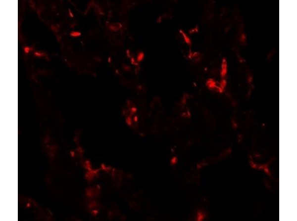 Immunofluorescence of NKX2-1