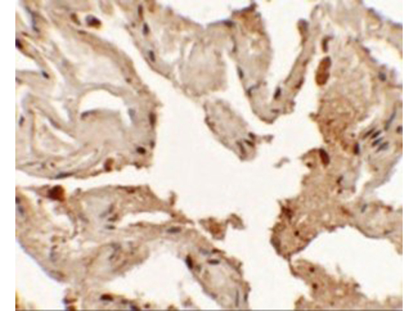 Immunohistochemistry of NKX2-1