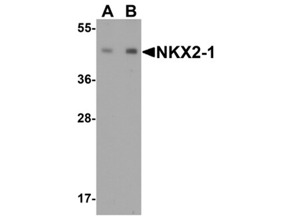 Western blot analysis of NKX2-1