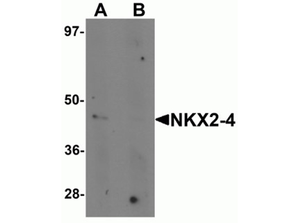 Western blot analysis of NKX2-4