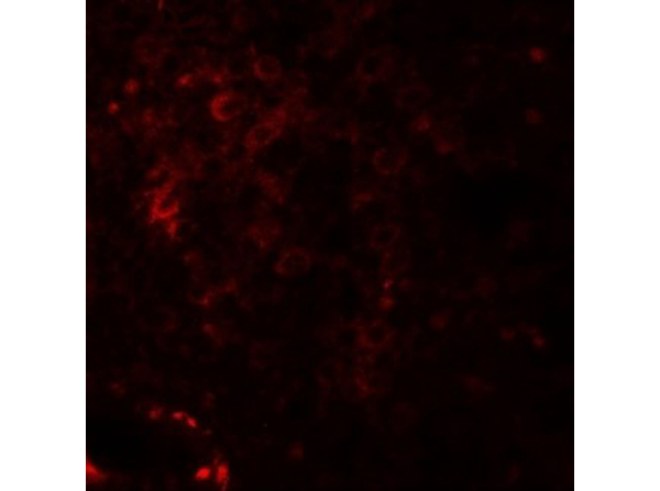 Immunofluorescence of NKX2-6