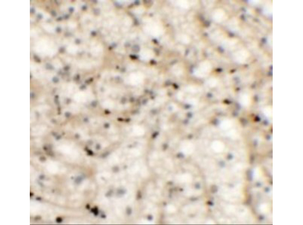 Immunohistochemistry of NKX2-6
