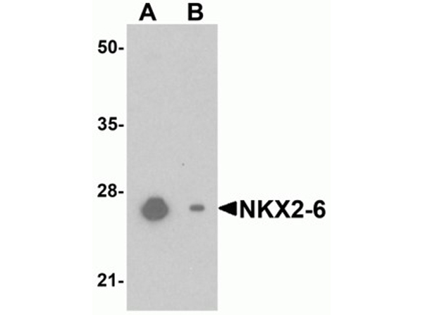 Western blot analysis of NKX2-6