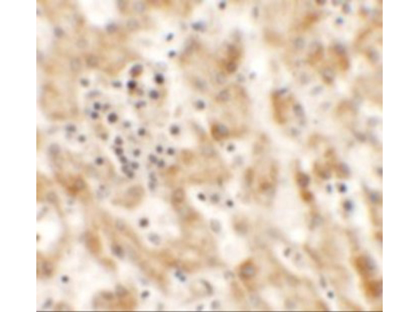Immunohistochemistry of NKX2-8