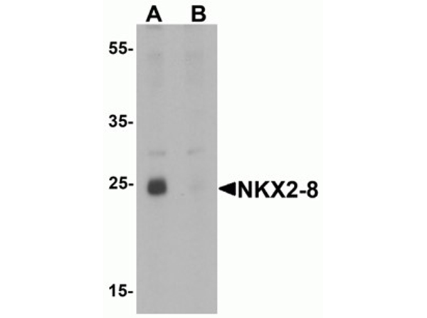 Western blot analysis of NKX2-8