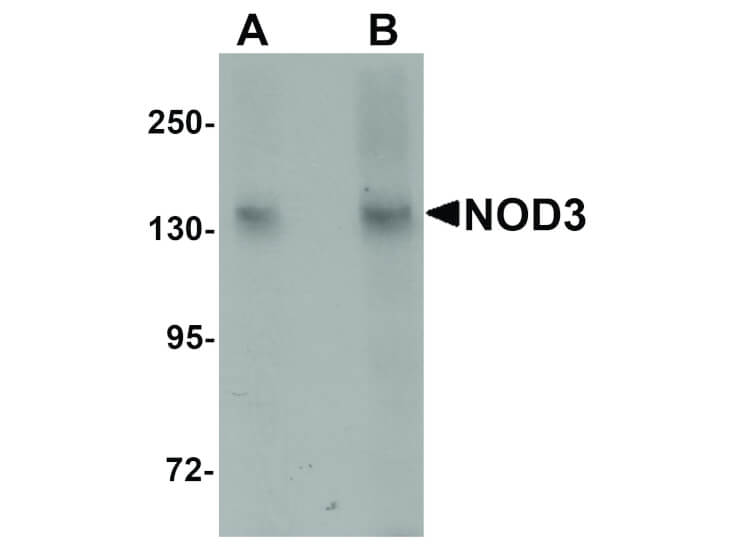 Western Blot of NOD3 Antibody