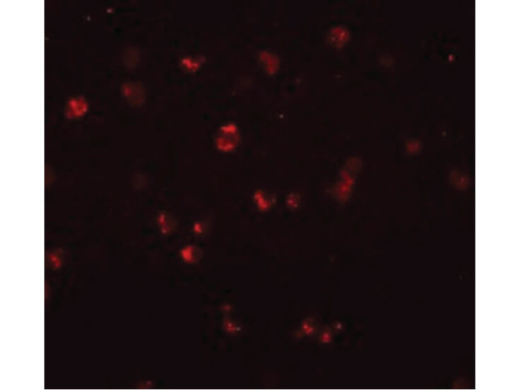 Immunofluorescence of NOD3 Antibody