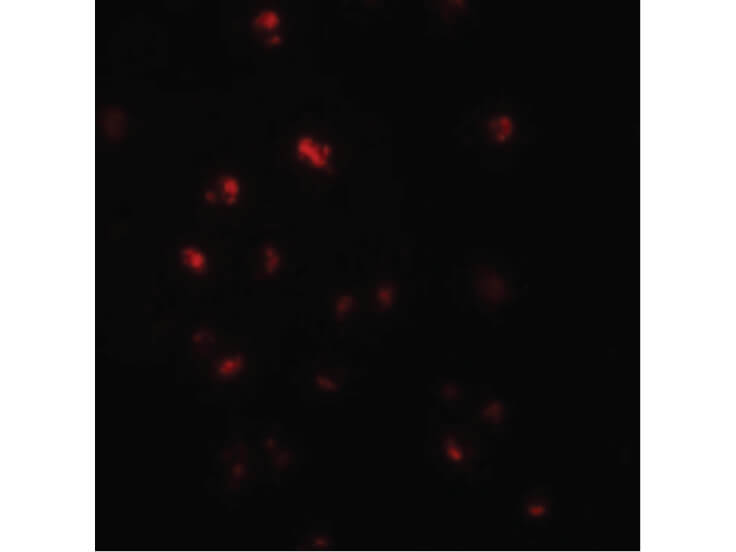 Immunofluorescence of NOD4 Antibody