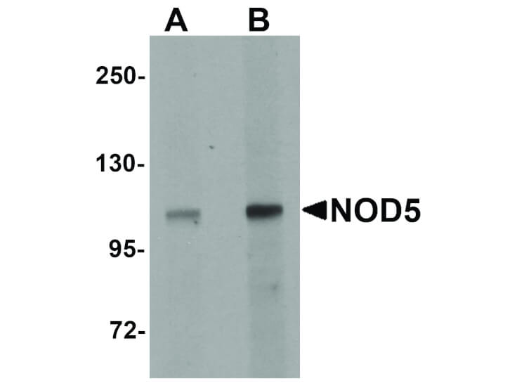 Western Blot of NOD5 Antibody