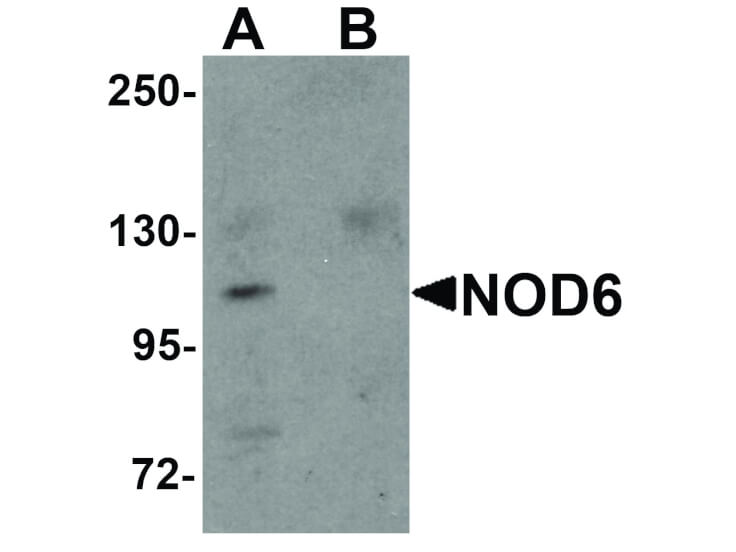 Western Blot of NOD6 Antibody