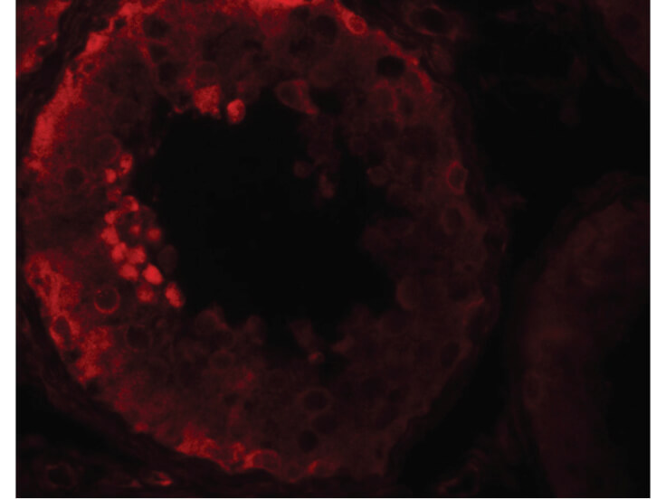 Immunofluorescence of NOD6 Antibody