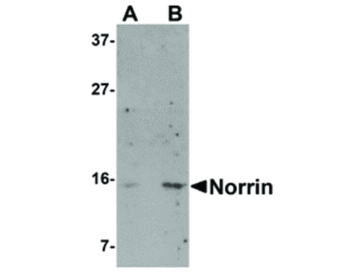 Western Blot of Norrin Antibody