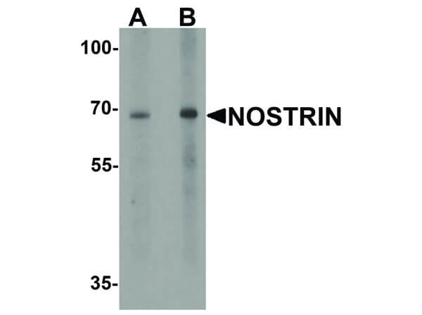 Western Blot of NOSTRIN Antibody