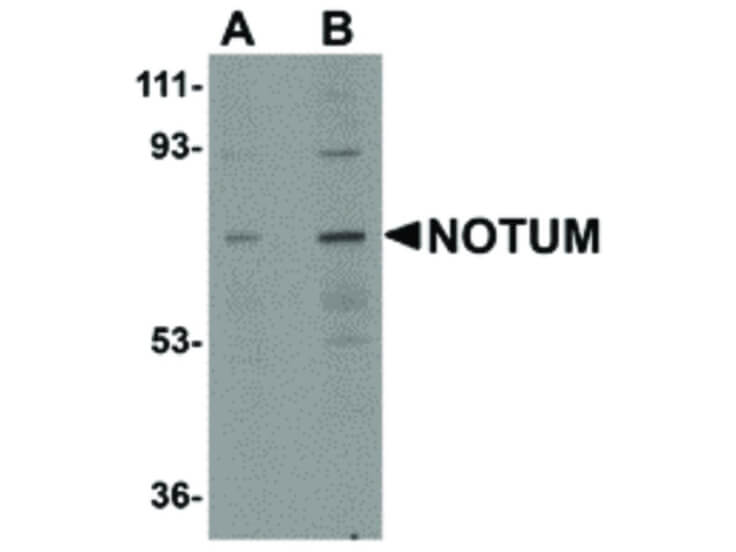 Western Blot of NOTUM Antibody