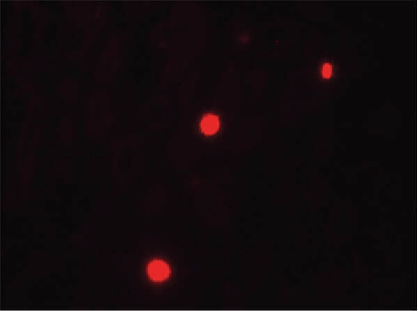 Immunofluorescence of NOX1 Antibody