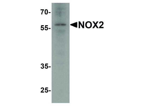 Western Blot of NOX2 Antibody