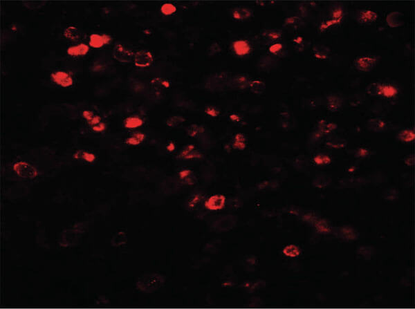 Immunofluorescence of NOX4 Antibody