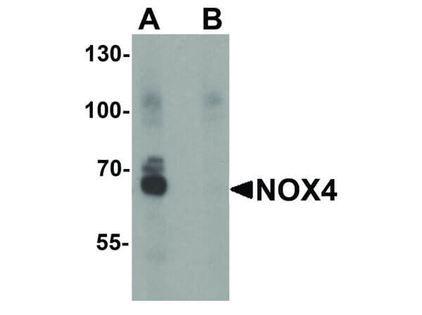 Western Blot of NOX4 Antibody