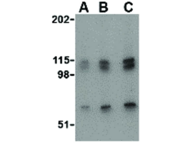 Western Blot of NPAS3 Antibody