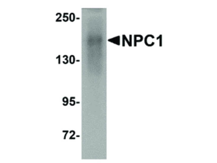 Western Blot of NPC1 Antibody