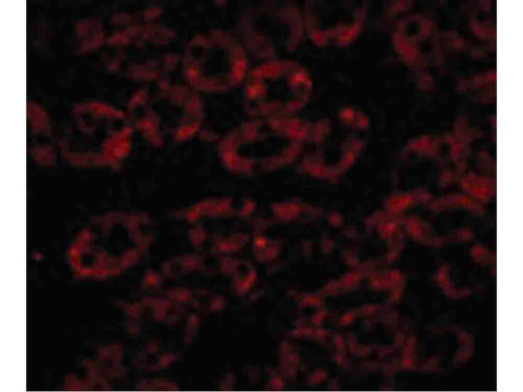 Immunofluorescence of NPC1 Antibody