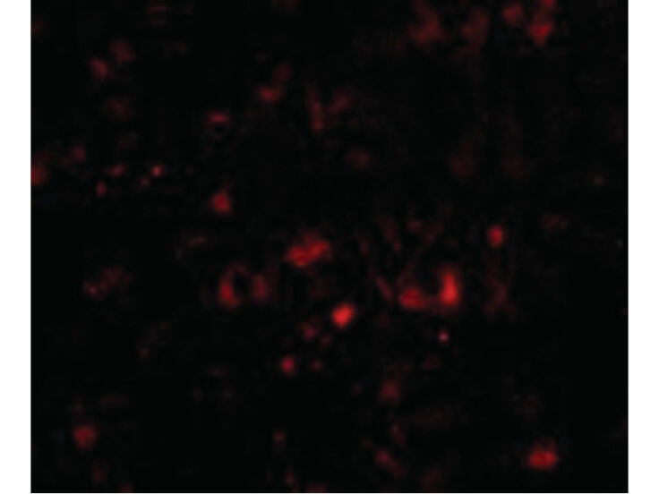 Immunofluorescence of NPTX2 Antibody