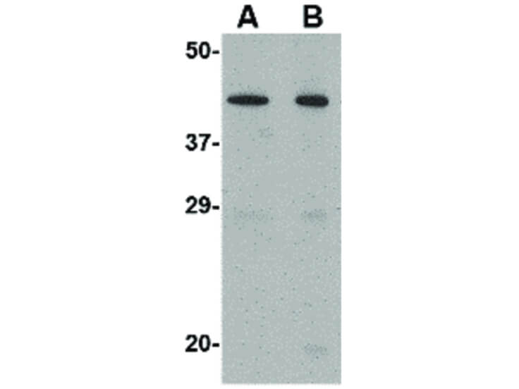 Western Blot of NPTX2 Antibody