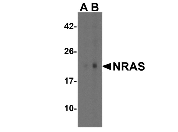 Western blot of NRAS