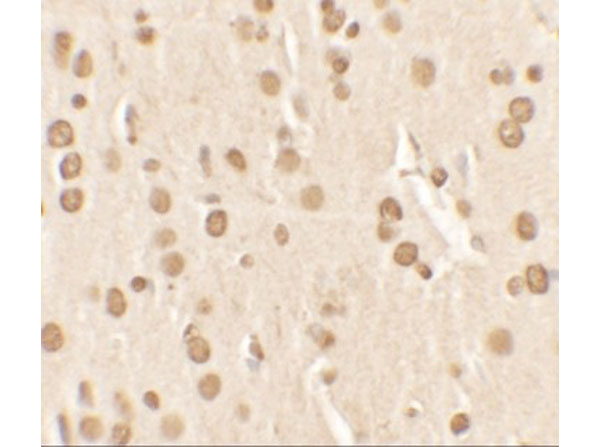 Immunohistochemistry of Nucleobindin-2