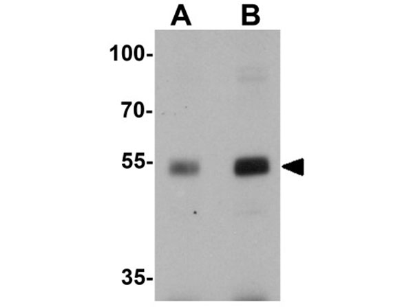 Western blot analysis of Nucleobindin-2