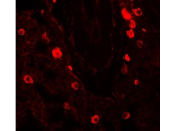 Immunofluorescence of NUMB