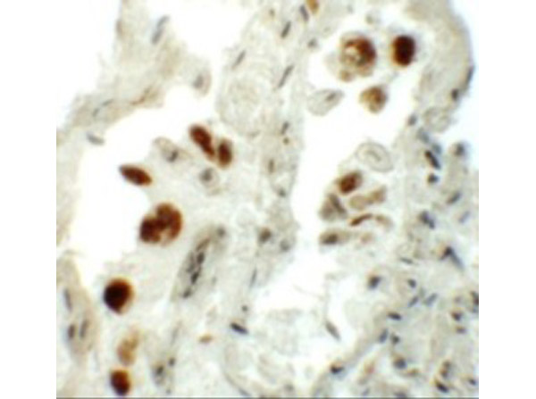 Immunohistochemistry of NUMB